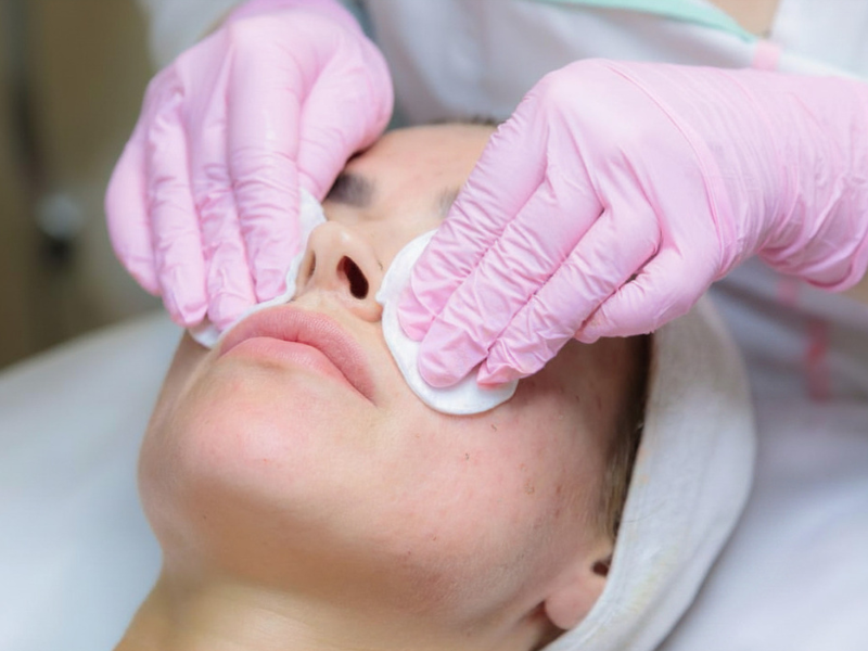 AzAc, A-QS Hacker i Neuro Sensi Therapy – jak dobrać protokół w trądziku pospolitym i różowatym?