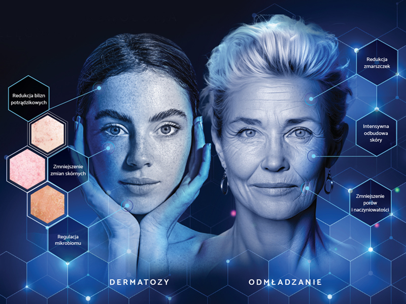 Egzosomy - nowe kierunki działania dla skóry z dermatozą