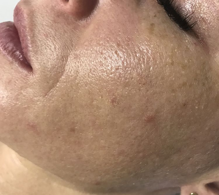 Neuro GABA & NANA Therapy