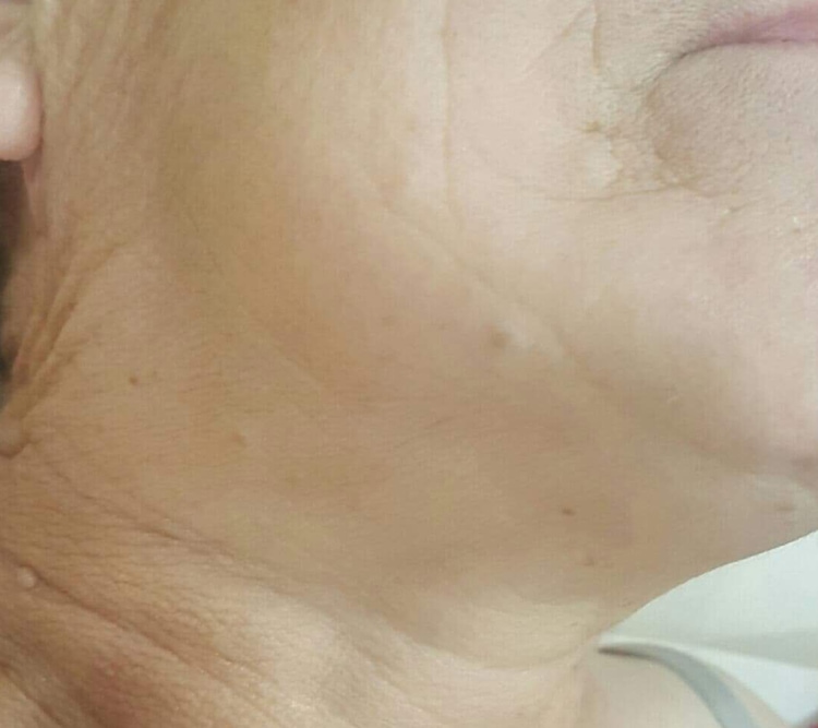 Neuro GABA & NANA Therapy
